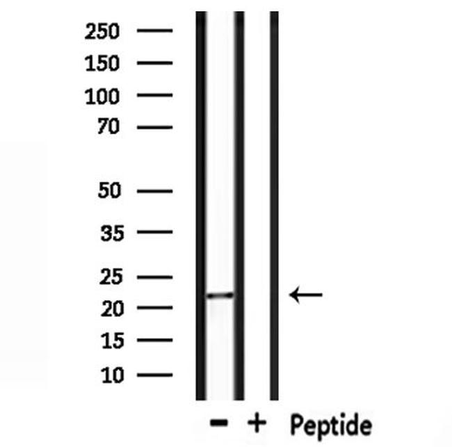 NOLA1 Antibody in Western Blot (WB)