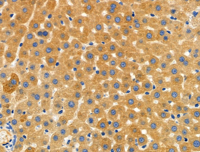 CYBA Antibody in Immunohistochemistry (Paraffin) (IHC (P))