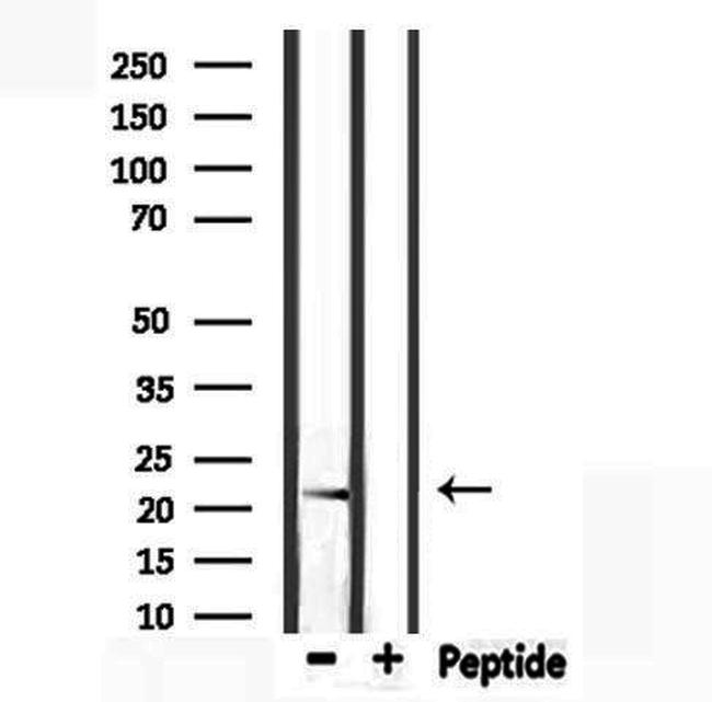 CYBA Antibody in Western Blot (WB)