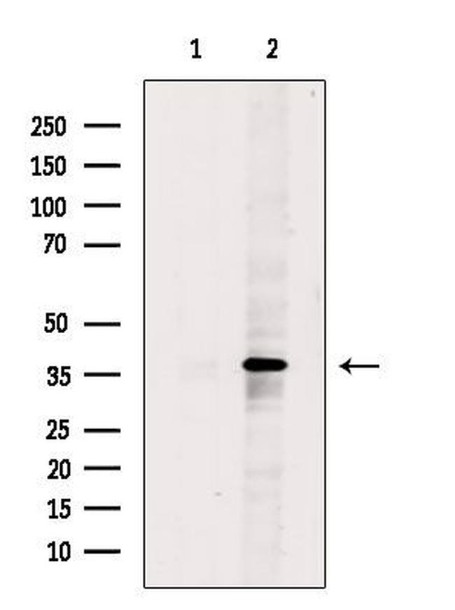 DNAJB2 Antibody in Western Blot (WB)