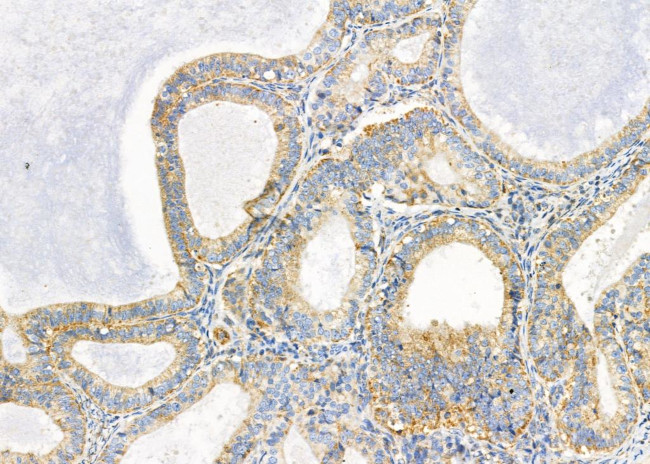 FBF1 Antibody in Immunohistochemistry (Paraffin) (IHC (P))