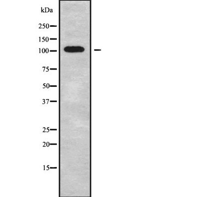 FBF1 Antibody in Western Blot (WB)