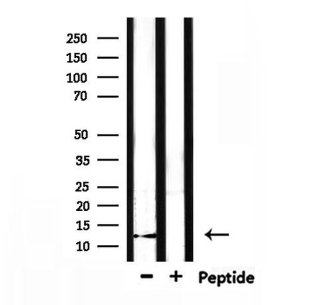 XCL1/XCL2 Antibody in Western Blot (WB)