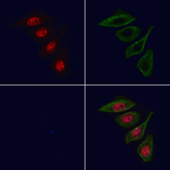 MCM8 Antibody in Immunocytochemistry (ICC/IF)