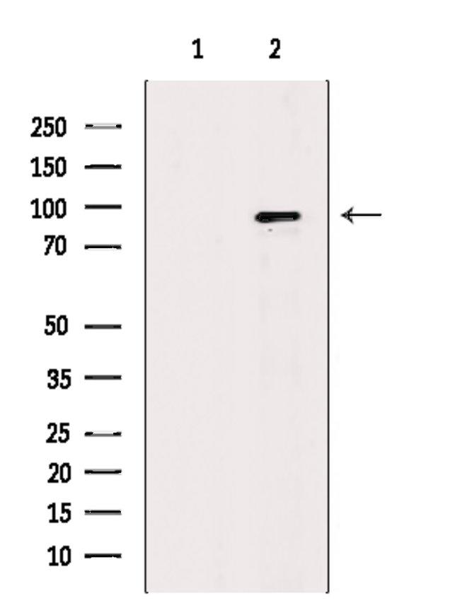 MCM8 Antibody in Western Blot (WB)