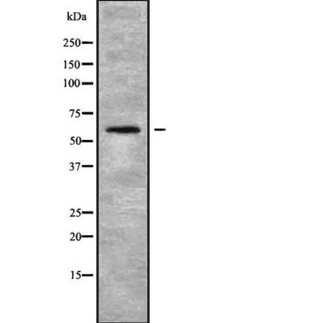 LILRB5 Antibody in Western Blot (WB)