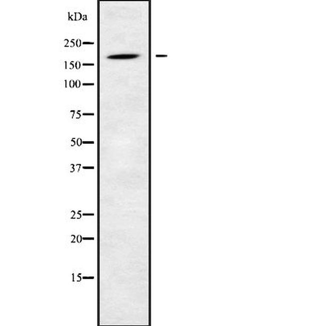 LTBP1 Antibody in Western Blot (WB)