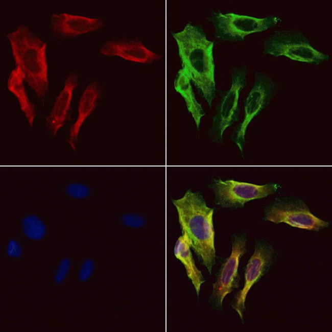 SCGN Antibody in Immunocytochemistry (ICC/IF)