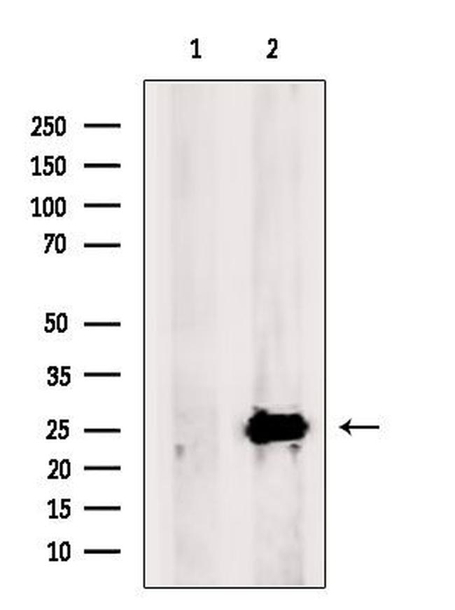 SCGN Antibody in Western Blot (WB)