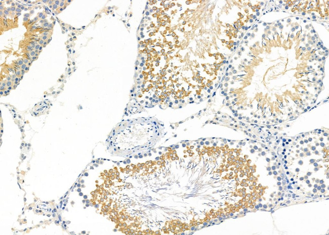 CREG1 Antibody in Immunohistochemistry (Paraffin) (IHC (P))