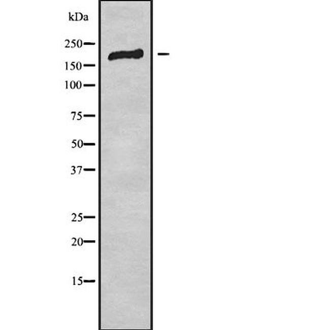 BAI2 Antibody in Western Blot (WB)