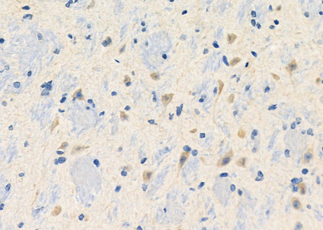 BAI3 Antibody in Immunohistochemistry (Paraffin) (IHC (P))