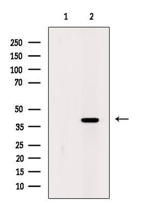 CCR4 Antibody in Western Blot (WB)