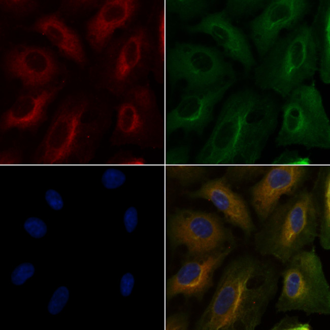 PTGER1 Antibody in Immunocytochemistry (ICC/IF)