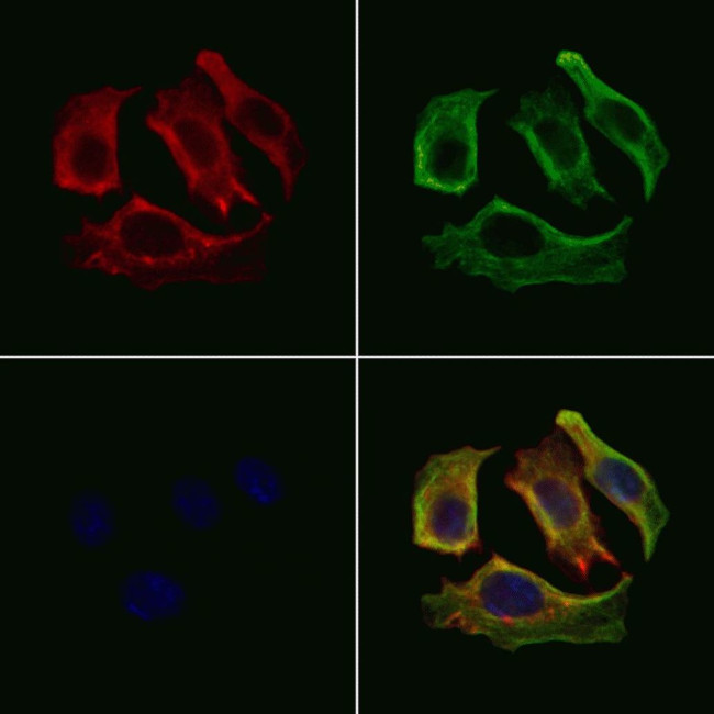 Opsin Blue Antibody in Immunocytochemistry (ICC/IF)