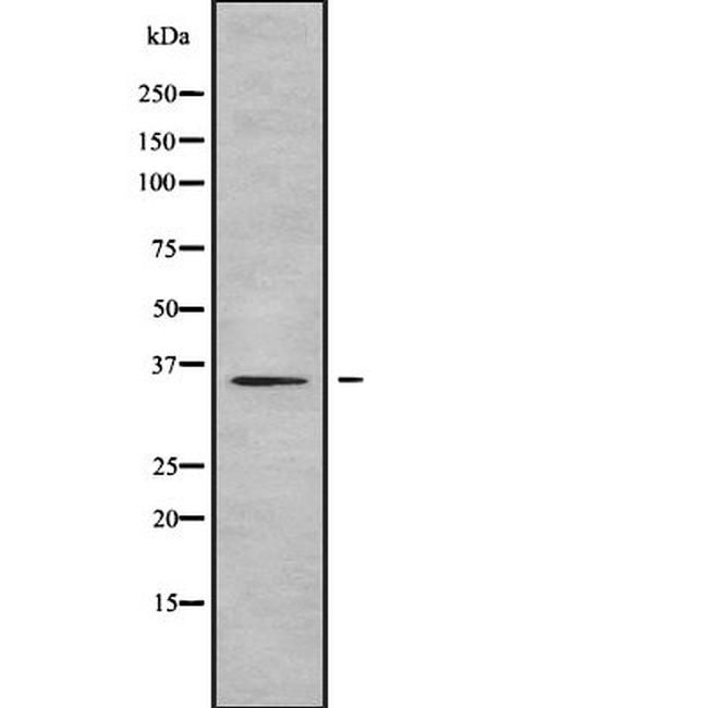 OR1E2 Antibody in Western Blot (WB)