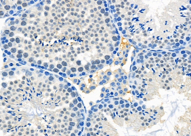 OR3A4 Antibody in Immunohistochemistry (Paraffin) (IHC (P))