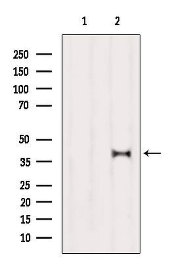 OR5T3 Antibody in Western Blot (WB)