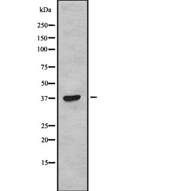 TAS2R38 Antibody in Western Blot (WB)