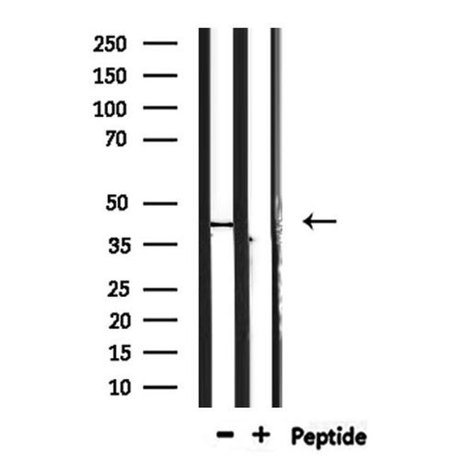 TAS2R40 Antibody in Western Blot (WB)