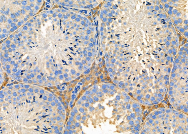 TAS2R9 Antibody in Immunohistochemistry (Paraffin) (IHC (P))