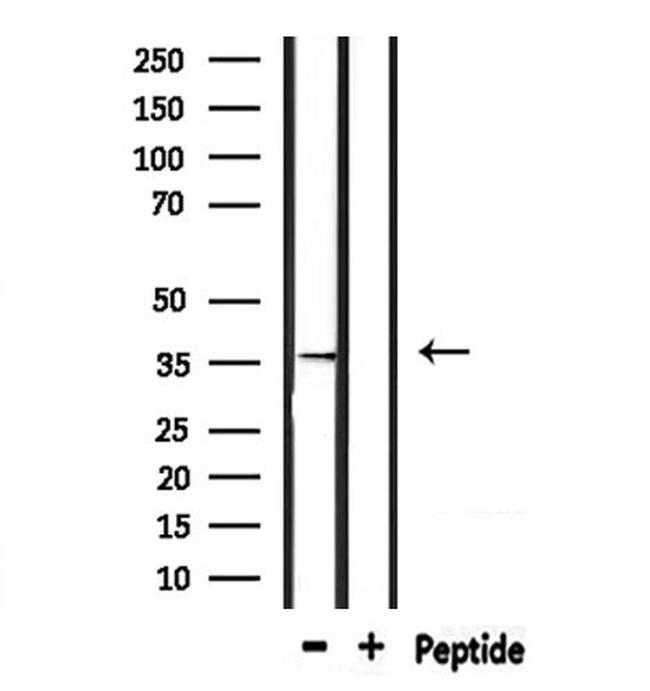 TAS2R9 Antibody in Western Blot (WB)