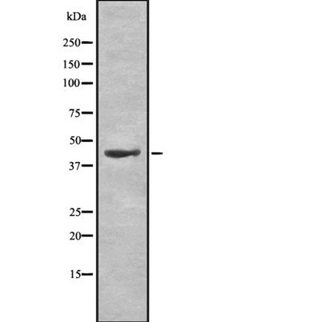 HCAR2/HCAR3 Antibody in Western Blot (WB)