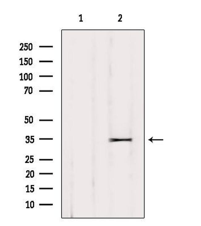 OR52L2P Antibody in Western Blot (WB)
