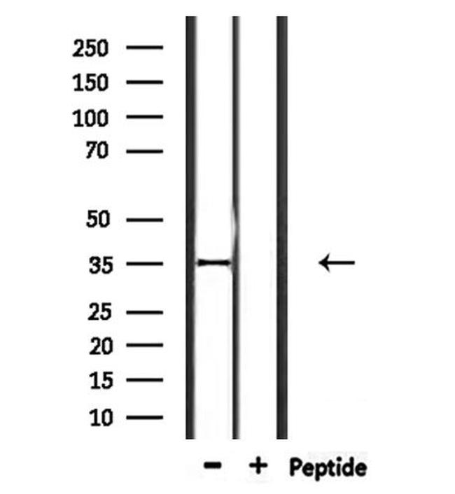 OR2L2 Antibody in Western Blot (WB)