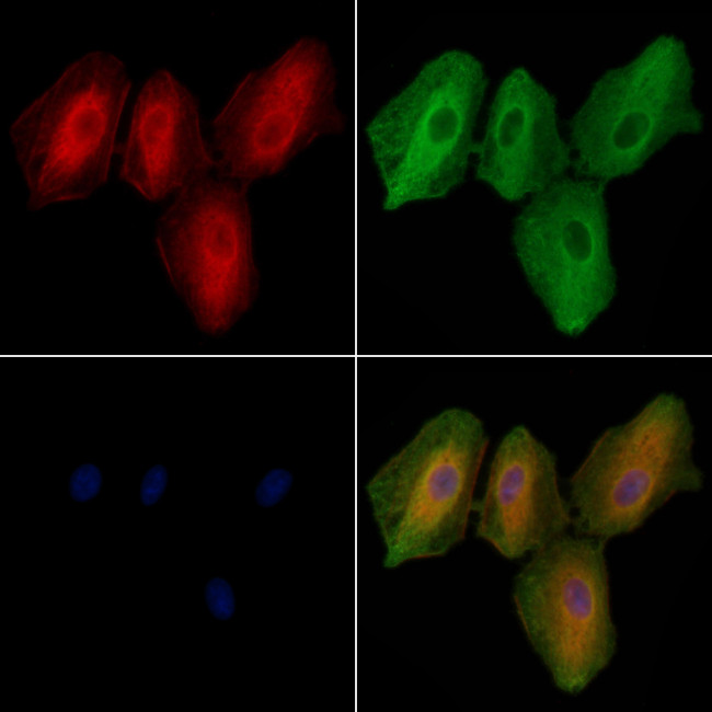 TAS2R31 Antibody in Immunocytochemistry (ICC/IF)