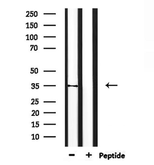 TAS2R31 Antibody in Western Blot (WB)