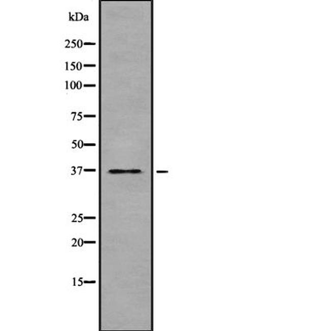 TAS2R30 Antibody in Western Blot (WB)