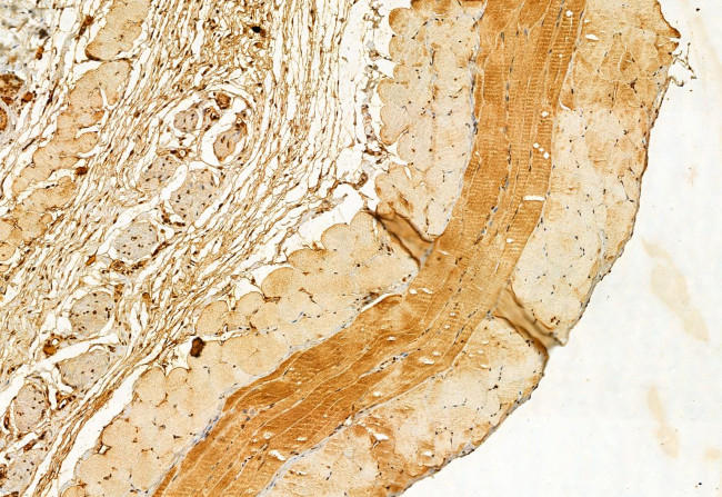 IFT88 Antibody in Immunohistochemistry (Paraffin) (IHC (P))