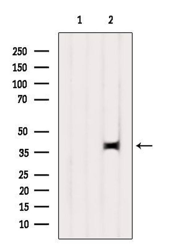 C2orf33 Antibody in Western Blot (WB)