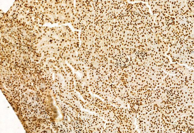 SHARPIN Antibody in Immunohistochemistry (Paraffin) (IHC (P))