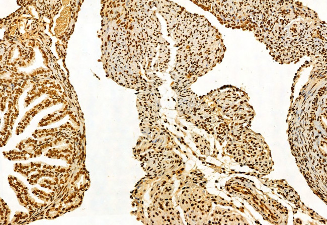 SHARPIN Antibody in Immunohistochemistry (Paraffin) (IHC (P))