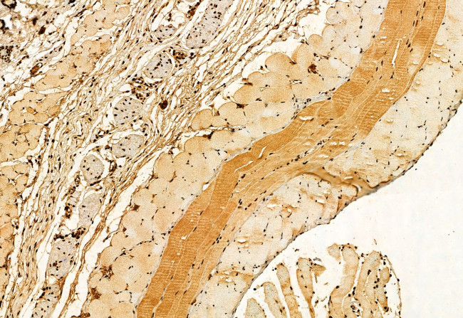 SHARPIN Antibody in Immunohistochemistry (Paraffin) (IHC (P))