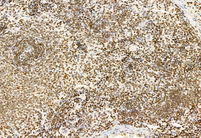 SHARPIN Antibody in Immunohistochemistry (Paraffin) (IHC (P))