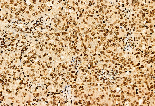 SHARPIN Antibody in Immunohistochemistry (Paraffin) (IHC (P))