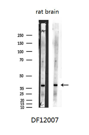 SHARPIN Antibody in Western Blot (WB)