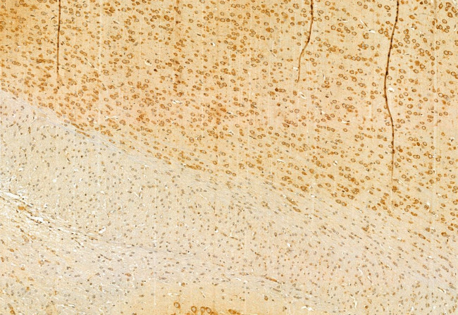 CNOT1 Antibody in Immunohistochemistry (Paraffin) (IHC (P))