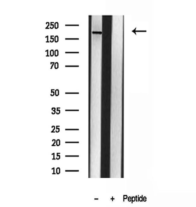 CNOT1 Antibody in Western Blot (WB)