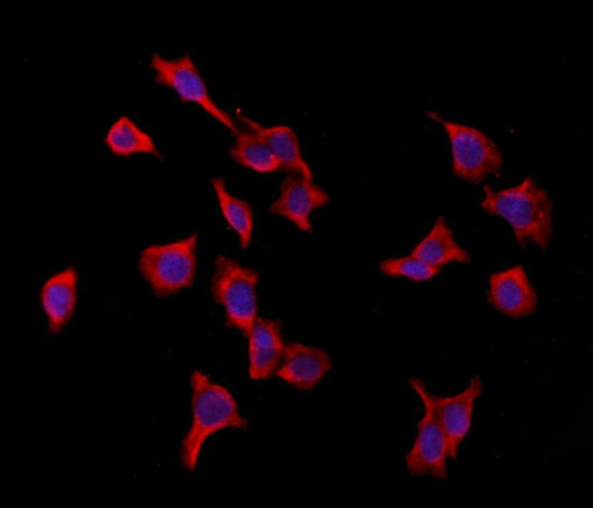 VPRBP Antibody in Immunocytochemistry (ICC/IF)