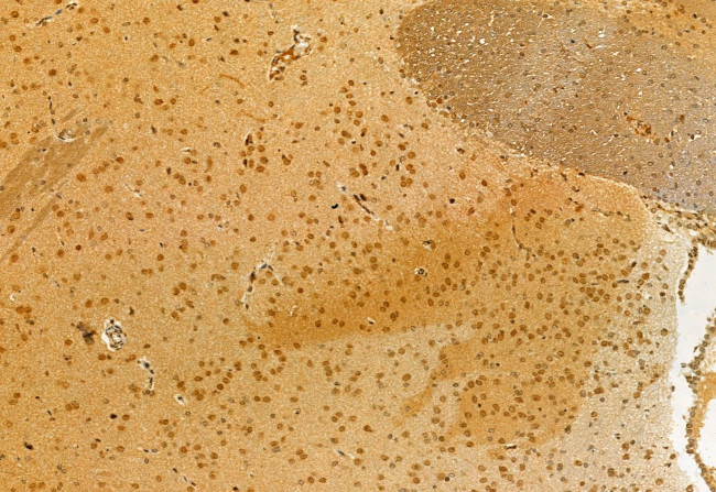 VPRBP Antibody in Immunohistochemistry (Paraffin) (IHC (P))