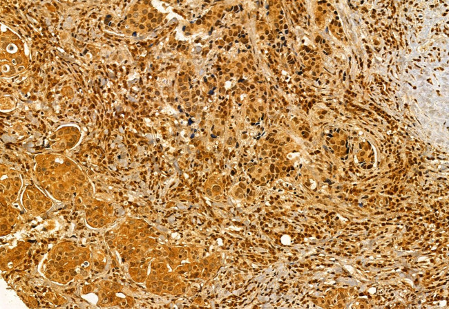 VPRBP Antibody in Immunohistochemistry (Paraffin) (IHC (P))