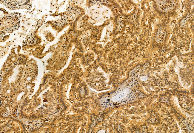 VPRBP Antibody in Immunohistochemistry (Paraffin) (IHC (P))