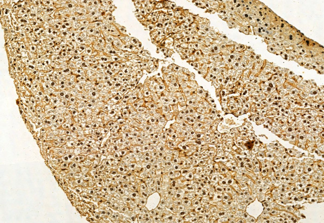 VPRBP Antibody in Immunohistochemistry (Paraffin) (IHC (P))