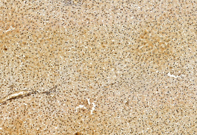 VPRBP Antibody in Immunohistochemistry (Paraffin) (IHC (P))