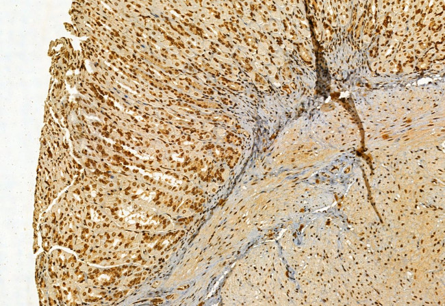 VPRBP Antibody in Immunohistochemistry (Paraffin) (IHC (P))