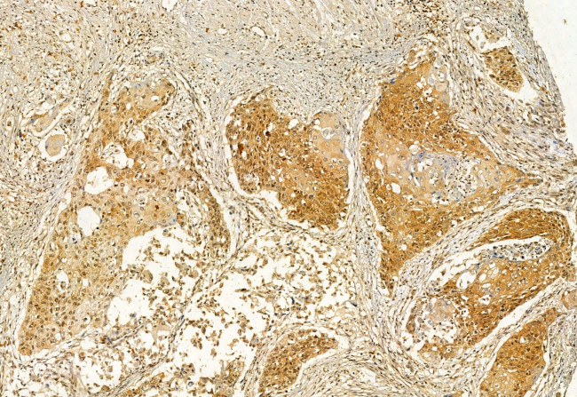 VPRBP Antibody in Immunohistochemistry (Paraffin) (IHC (P))